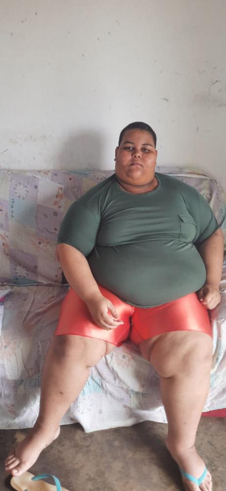 Jovem obeso pede ajuda para emagrecer