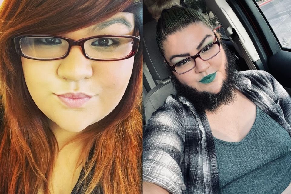 Mulher barbada desiste de se depilar e faz sucesso com conteúdo adulto