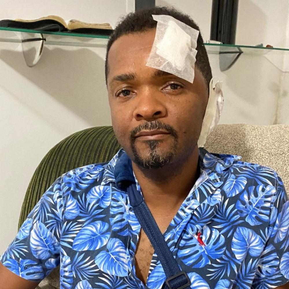 Kuelho após acidente: 